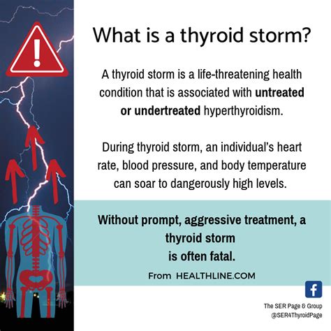 thyroid storm mdcalc|Thyroid storm .